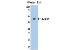 Western Blotting (WB) image for anti-Keratin 16 (KRT16) (AA 117-419) antibody (ABIN1172993) (KRT16 Antikörper  (AA 117-419))