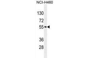 Western Blotting (WB) image for anti-Mesoderm Induction Early Response 1, Family Member 2 (MIER2) antibody (ABIN2996066) (MIER2 Antikörper)