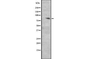 Western blot analysis of CCNT2 expression in HepG2 whole cell lysate ,The lane on the left is treated with the antigen-specific peptide. (Cyclin T2 Antikörper  (Internal Region))