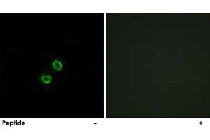 Immunofluorescence analysis of A-549 cells, using KIR2DL5B polyclonal antibody .