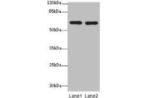 Western blot All lanes: CNOT2 antibody at 2 μg/mL Lane 1: 293T whole cell lysate Lane 2: Jurkat whole cell lysate Secondary Goat polyclonal to rabbit IgG at 1/10000 dilution Predicted band size: 60, 41, 23, 52, 55 kDa Observed band size: 60 kDa (CNOT2 Antikörper  (AA 1-335))