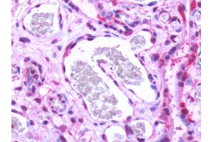 Human, Placenta: Formalin-Fixed Paraffin-Embedded (FFPE) (S1PR1 Antikörper  (Cytoplasmic Domain))