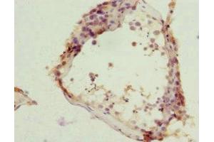 Immunohistochemistry of paraffin-embedded human testis tissue using ABIN7161952 at dilution of 1:100 (ZC3HC1 Antikörper  (AA 1-260))