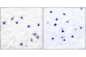 Immunohistochemistry analysis of paraffin-embedded human brain, using Tyrosine Hydroxylase (Phospho-Ser19) Antibody. (Tyrosine Hydroxylase Antikörper  (pSer18))