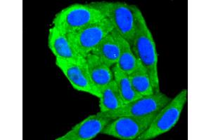 HepG2 cells were fixed in paraformaldehyde, permeabilized with 0. (Cytokeratin 18 Antikörper)