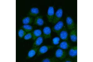 IF analysis of TSTA3/GFUS using anti-TSTA3/GFUS antibody (ABIN7825400). (GFUS (AA 44-321) Antikörper)