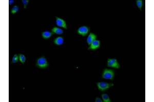 Immunofluorescence staining of Hela cells with ABIN7161649 at 1:133, counter-stained with DAPI. (KLRC3 Antikörper  (AA 94-240))