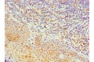 Immunohistochemistry of paraffin-embedded human tonsil tissue using ABIN7161993 at dilution of 1: 100 (TIA1 Antikörper  (AA 1-193))