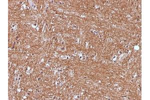 Formalin-fixed, paraffin-embedded human Cerebellum stained with NSE gamma Monoclonal Antibody (ENO2/1375). (ENO2/NSE Antikörper  (AA 416-433))
