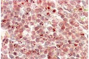 AP32078PU-N MLL2 Antibody staining of paraffin embedded Human Liver at 3. (MLL2 Antikörper  (N-Term))
