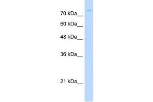 ZNF709 antibody (20R-1237) used at 0. (ZNF709 Antikörper  (N-Term))