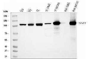 Western blot analysis of SND1 using anti-SND1 antibody (ABIN7600525). (SND1 Antikörper  (AA 20-204))