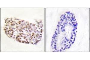 Immunohistochemistry analysis of paraffin-embedded human thyroid gland tissue, using NFAT5 (Ab-1197) Antibody. (NFAT5 Antikörper  (AA 1171-1220))
