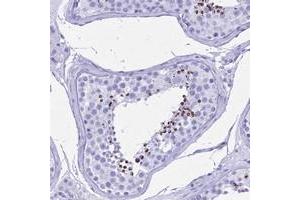 Immunohistochemical staining of human testis with PATE4 polyclonal antibody  shows strong cytoplasmic positivity in cells in seminiferus ducts at 1:50-1:200 dilution. (PATE4 Antikörper)
