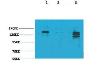 Western Blot (WB) analysis of 1) Rat Brain Tissue, 2)Mouse Brain Tissue, 3) HeLa with SLC12A4 Rabbit Polyclonal Antibody diluted at 1:2000. (SLC12A4 Antikörper)
