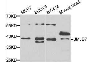 Western blot analysis of extracts of various cell lines, using JMJD7 antibody. (JMJD7 Antikörper)