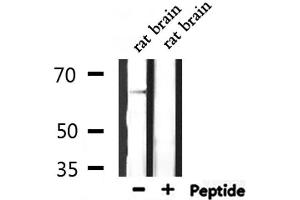 Western blot analysis of extracts from rat brain, using SLC6A1 Antibody. (SLC6A1 Antikörper  (Internal Region))