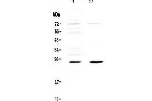 Western blot analysis of IL6 using anti-IL6 antibody .