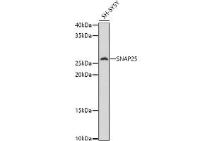 Western Blotting (WB) image for anti-Synaptosomal-Associated Protein, 25kDa (SNAP25) (AA 1-206) antibody (ABIN3021232)