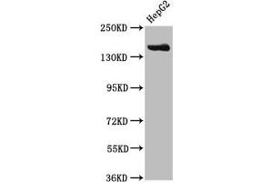 Western Blot Positive WB detected in: HepG2 whole cell lysate All lanes: CPS1 antibody at 3. (CPS1 Antikörper  (AA 1361-1500))