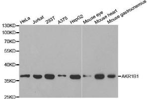 Western blot analysis of extracts of various cell lines, using AKR1B1 antibody. (AKR1B1 Antikörper  (AA 1-316))