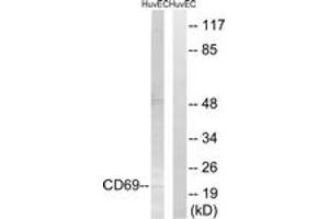 Western Blotting (WB) image for anti-CD69 (CD69) (AA 101-150) antibody (ABIN2890294) (CD69 Antikörper  (AA 101-150))