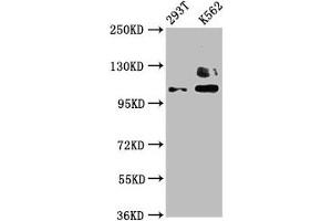Western Blot Positive WB detected in: 293T whole cell lysate, K562 whole cell lysate All lanes: ZNF268 antibody at 4 μg/mL Secondary Goat polyclonal to rabbit IgG at 1/50000 dilution Predicted band size: 109, 90, 10, 12, 16, 6, 13 kDa Observed band size: 109 kDa