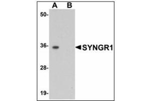 Western blot analysis of SYNGR1 in rat brain tissue lysate with SYNGR1 antibody at 1 µg/ml in (A) the absence and (B) the presence of blocking peptide. (Synaptogyrin 1 Antikörper)