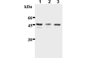 Western Blotting (WB) image for anti-Inhibitor of kappa Light Polypeptide Gene Enhancer in B-Cells, Kinase gamma (IKBKG) (AA 61-137) antibody (ABIN567773) (IKBKG Antikörper  (AA 61-137))