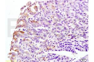 Formalin-fixed and mouse stomach tissue labeled with Anti-CK8 Polyclonal Antibody, Unconjugated (ABIN737751) at 1:200 followed by conjugation to the secondary antibody and DAB staining (KRT8 Antikörper  (AA 51-150))