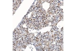 Immunohistochemistry (IHC) image for anti-Baculoviral IAP Repeat-Containing 5 (BIRC5) (AA 1-142) antibody (ABIN6137562)