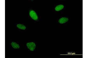 Immunofluorescence of purified MaxPab antibody to FLJ10154 on HeLa cell. (ARGLU1 Antikörper  (AA 1-273))