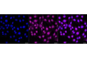 Immunocytochemical staining of C2C12 cells with AKT1 antibody (ABIN7800783), 1:1,000).