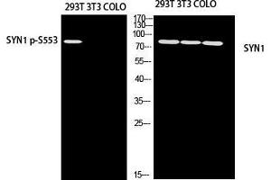 Western Blot (WB) analysis of 293T 3T3 COLO205 using SYN1 antibody. (SYN1 Antikörper)