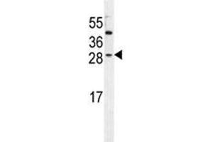 Western Blotting (WB) image for anti-Insulin-Like Growth Factor 2 (IGF2) (AA 39-68) antibody (ABIN3031346)