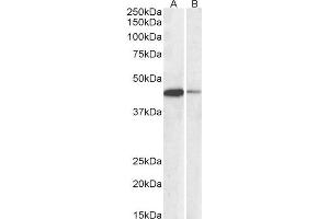 ABIN2561997 (0. (CREB1 Antikörper  (AA 96-109))