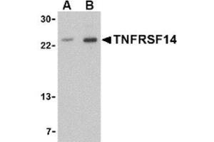 Image no. 1 for anti-Tumor Necrosis Factor Receptor Superfamily, Member 14 (TNFRSF14) (N-Term) antibody (ABIN265160) (HVEM Antikörper  (N-Term))