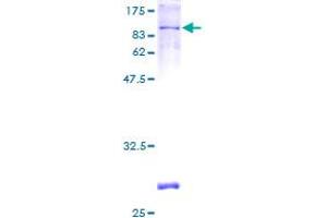 PDE4D Protein (AA 1-518) (GST tag)