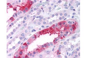 Immunohistochemistry (IHC) image for anti-serum/glucocorticoid Regulated Kinase Family, Member 3 (SGK3) (N-Term) antibody (ABIN1049327)