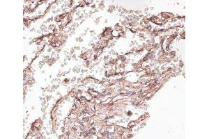 Immunohistochemistry of paraffin-embedded Human lung using COL6A1 Polyclonal Antibody at dilution of 1:100 (40x lens). (COL6A1 Antikörper)