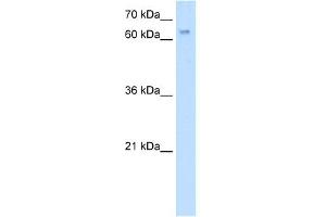 WB Suggested Anti-RBM35A Antibody Titration:  5. (ESRP1 Antikörper  (N-Term))