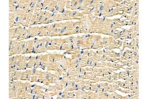 ABIN6259653 and ABIN6266917 at 1/100 staining Rat heart tissue by IHC-P. (Serotonin Receptor 5A Antikörper  (Internal Region))