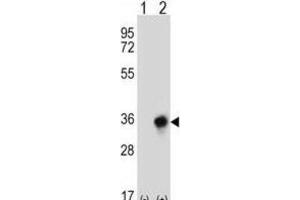 Western Blotting (WB) image for anti-Carbonyl Reductase 3 (CBR3) antibody (ABIN2997011) (CBR3 Antikörper)