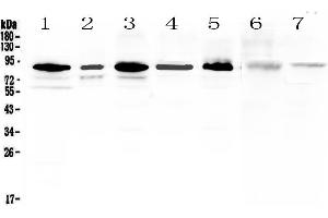Western blot analysis of MED15 using anti-MED15 antibody .