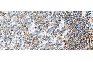 Immunohistochemistry of paraffin-embedded Human tonsil tissue using GLS Polyclonal Antibody at dilution of 1:70(x200) (Glutaminase Antikörper)