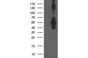Western Blotting (WB) image for anti-Cerebral Cavernous Malformation 2 (CCM2) antibody (ABIN1497136) (CCM2 Antikörper)
