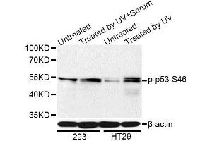 Western blot analysis of extracts of 293 and HT-29 cells, using Phospho-p53-S46 antibody (ABIN5969969) at 1/1000 dilution. (p53 Antikörper  (pSer46))
