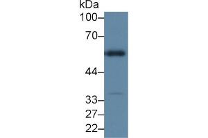Western Blot; Sample: Mouse Kidney lysate; Primary Ab: 2µg/ml Rabbit Anti-Mouse HYAL1 Antibody Second Ab: 0.