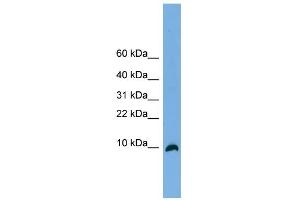 WB Suggested Anti-C18orf56 Antibody Titration: 0. (C18orf56 Antikörper  (N-Term))