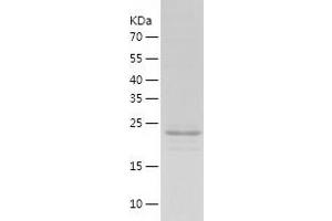 Western Blotting (WB) image for alpha-Actinin Skeletal Muscle (ACTN) (AA 1-249) protein (His tag) (ABIN7285350) (alpha Actinin Protein (AA 1-249) (His tag))